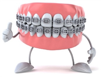 Straight Teeth Equals Healthy Teeth