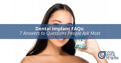 Dental Implant FAQs By Social Dental Network